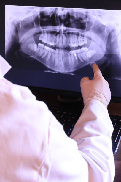 Best Broken Tooth Emergency  in Lawton, IA